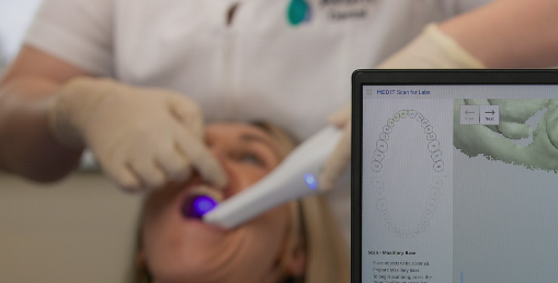 Benefits of Having a Dental Lab with CAD CAM
