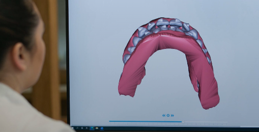 Dental CAD/CAM – All You Need to Know