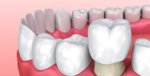 How To Choose The Right Dental Material For You