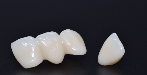 The Most Commonly Used Dental Material - Zirconia