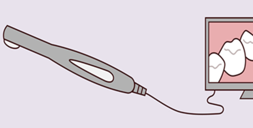 What is an Intraoral Scanner