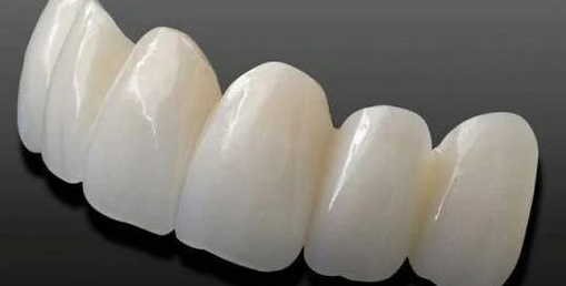 The Most Important Considerations for Dental Repairs