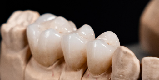 Effect of occlusal thickness design on fracture resistance of dental materials