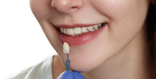 Things You Need to Know About Zirconia Dental Crowns