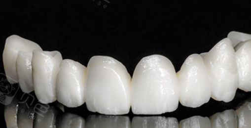 Dental Zirconia: Revolutionizing Modern Dentist