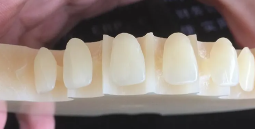 Why Pmma Materials Are Used in Dentistry