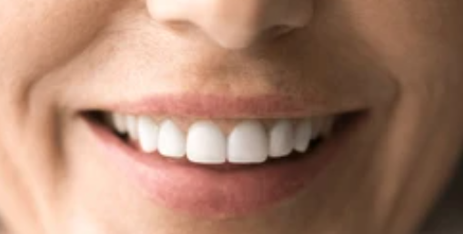 6 Best Materials for Dental Crowns