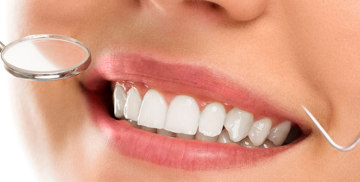 Which Type Of Dental Veneer Is Better?