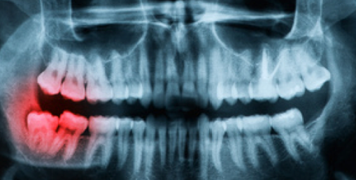 Digital Radiography