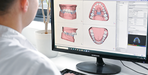 Understanding The CAD/CAM Workflow In Dentistry