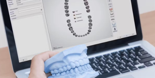 The Types Of Dental Software Programs
