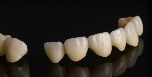 The Star Material Of Modern Dental Restoration
