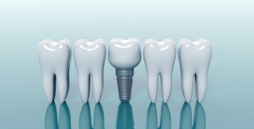 Why Do Dentists And Technicians Need To Know A Little About Dental Materials?
