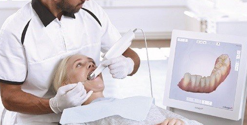 Learn About The Working Principle And Application Of Oral Scanners