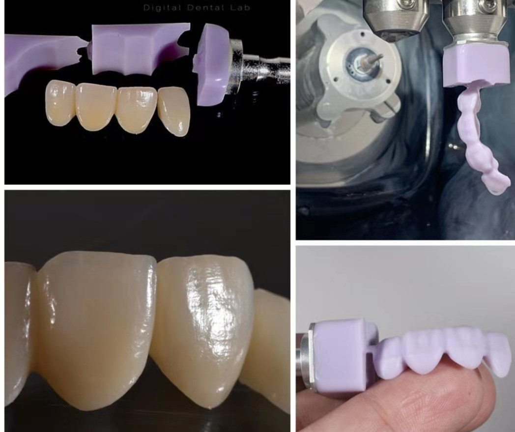 disilicato di litio dentale.jpg disilicato di litio dentale.jpg