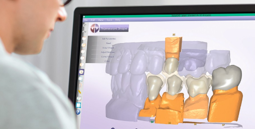 CAD/CAM : Advantages Compared To Traditional Methods