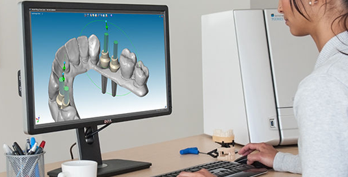 The Impact of Dental CAD/CAM Technology on the Future of Dental Surgery