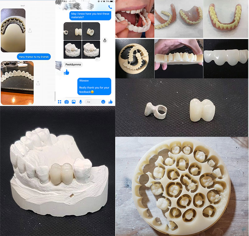 Dental PMMA