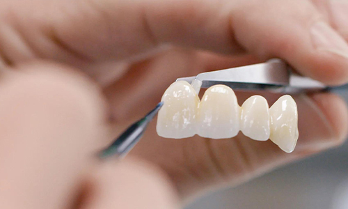 Zirconia posterior tooth crown production process