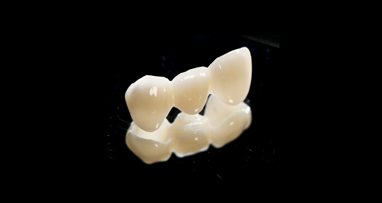 Zirconia from A to Z(2) Zirconia from A to Z(2)