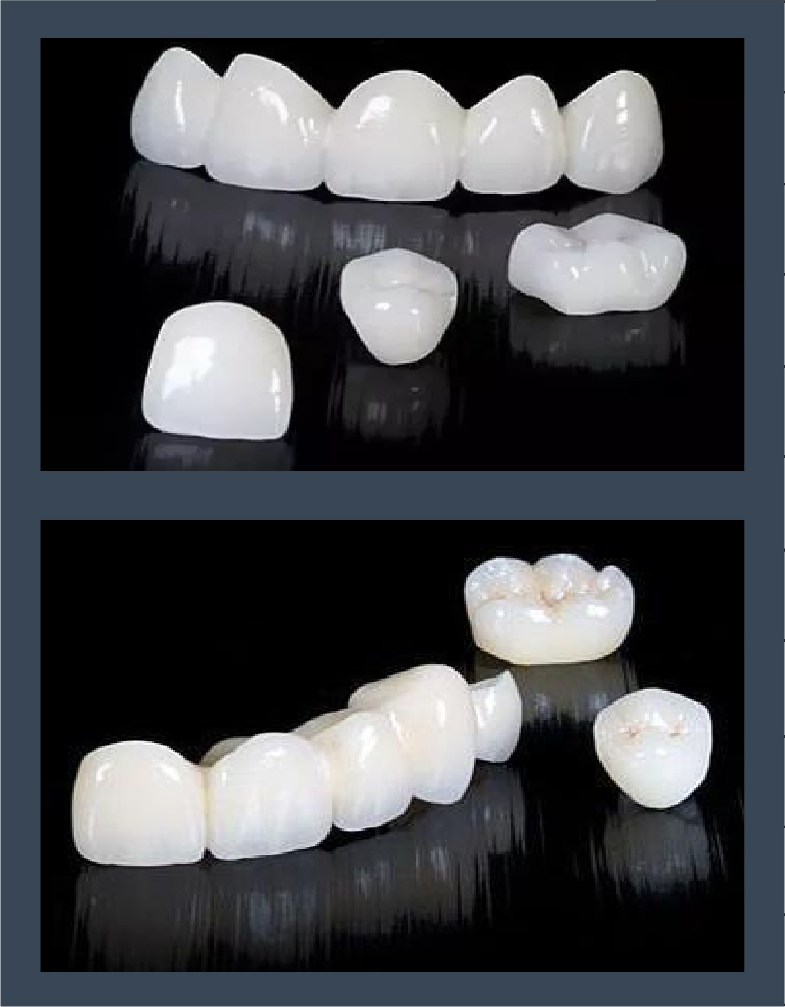 Zirconia Properties