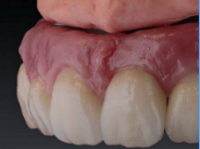 Dental Multilayer Zirconia Block