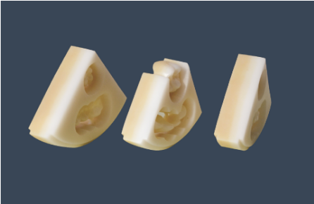 Dental Multilayer Zirconia Block