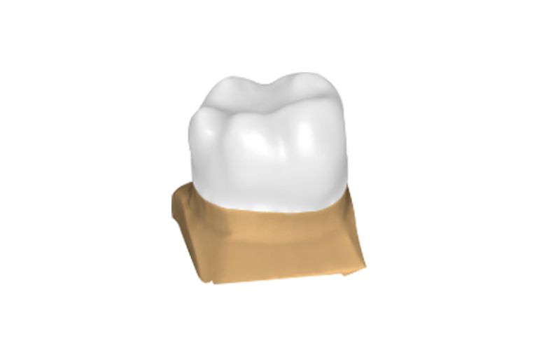 General Design Project