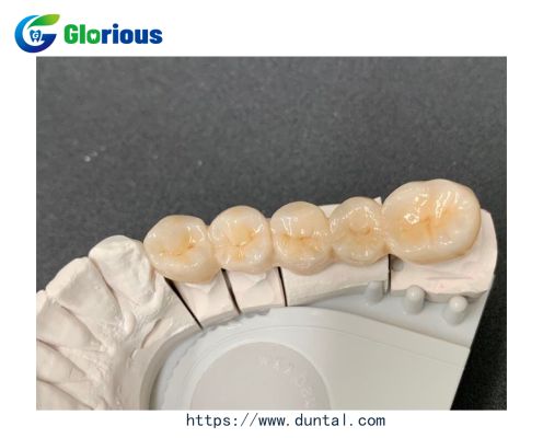 Which dentures are best?