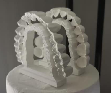 Which dentures are better