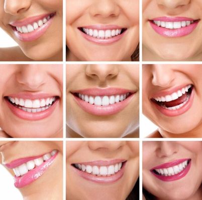 What are the common dental materials?