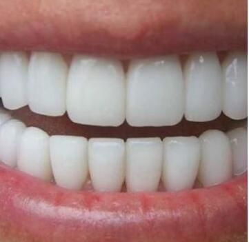 Want to straighten your teeth, but hesitate to make a decision because you don't know much about orthodontics?