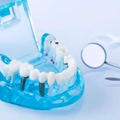 The principle of telescopic denture