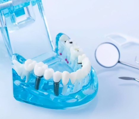 Still hesitating about getting your teeth straightened? Everything you want to know is here!