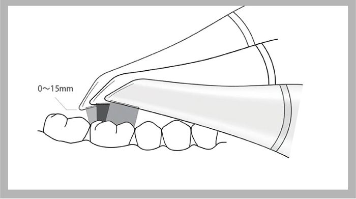 Dental intraoral scanner have many advantages